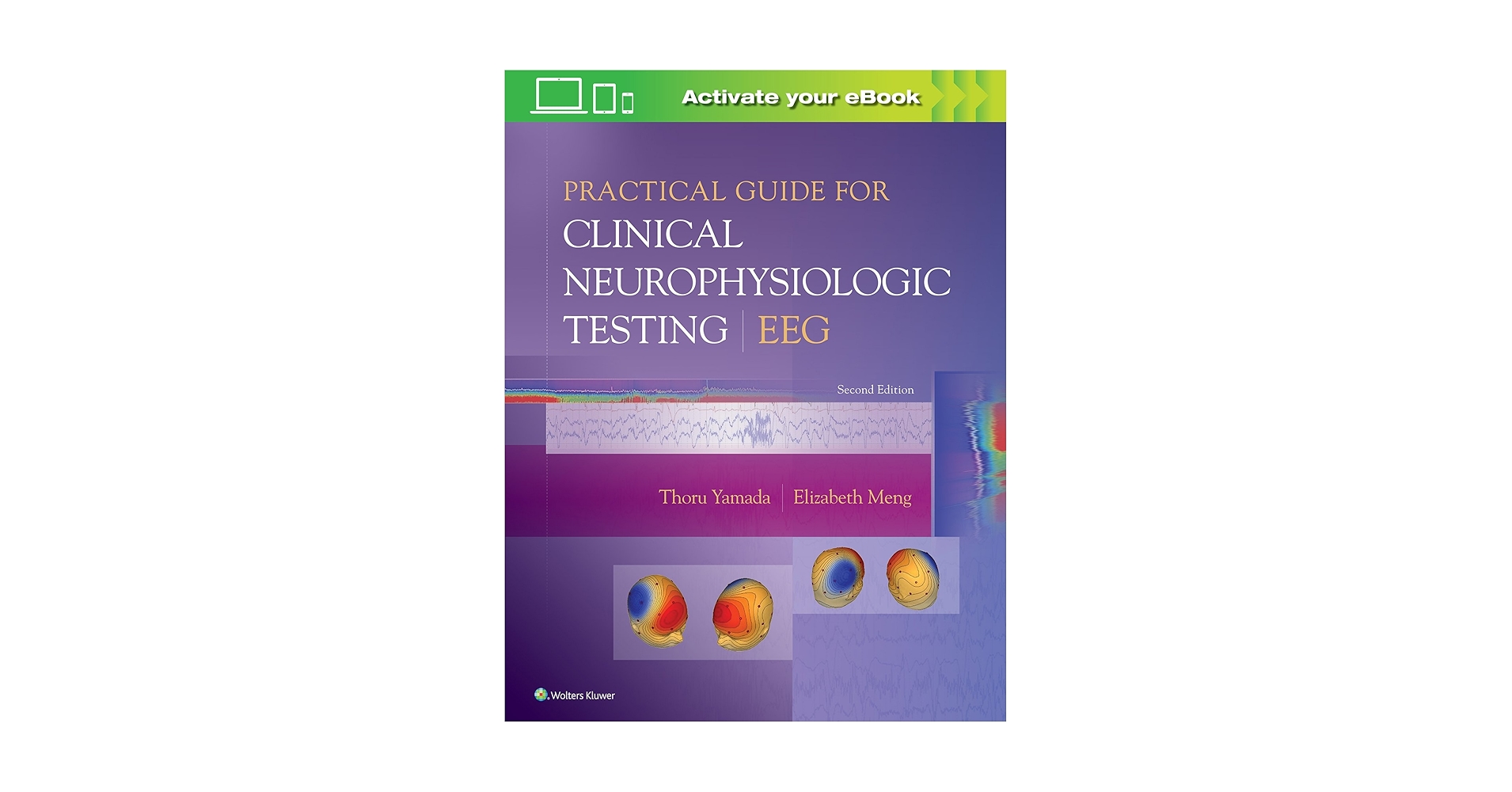 Practical Guide for Clinical Neurophysiologic Testing: EEG